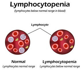 lymphocytopenia causes