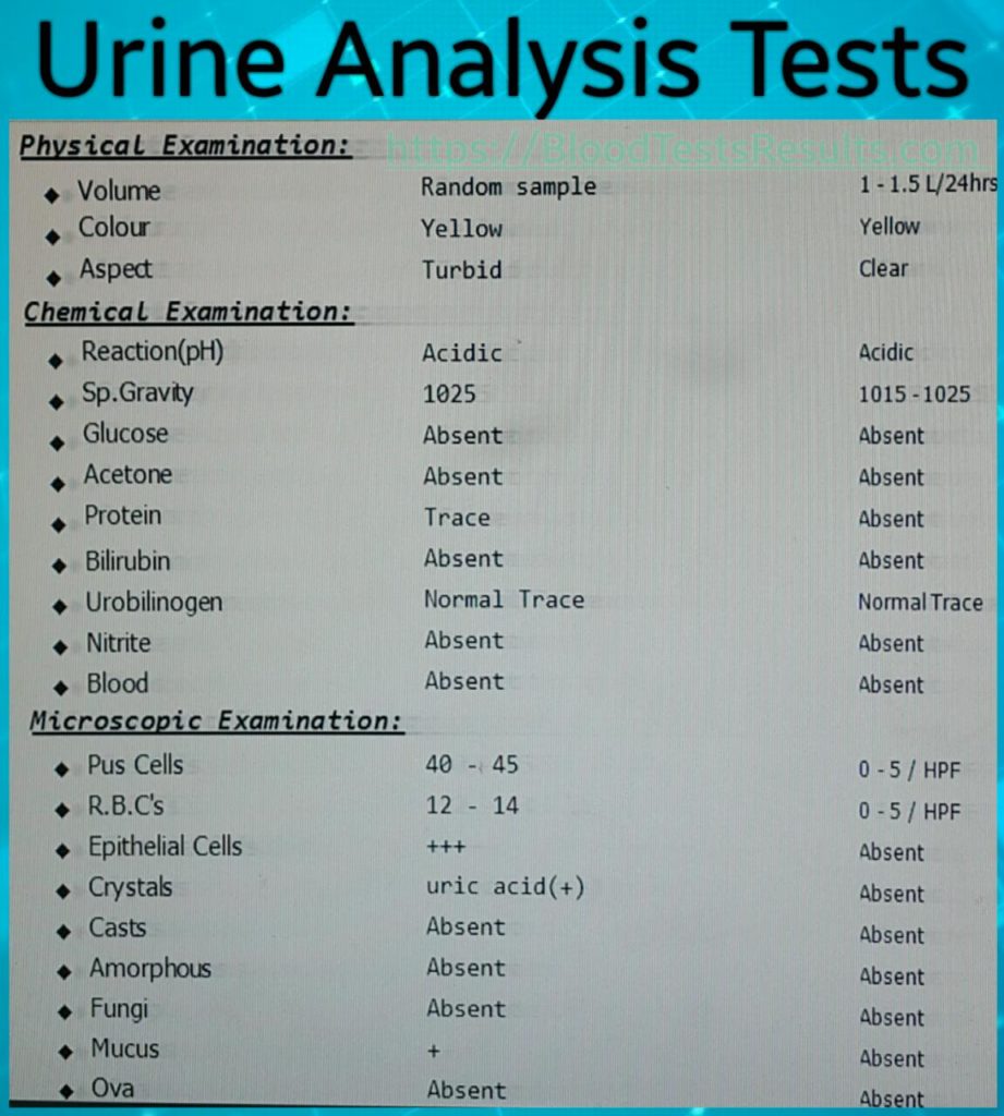 The report of a urine analysis shows all tests inside the urine analysis