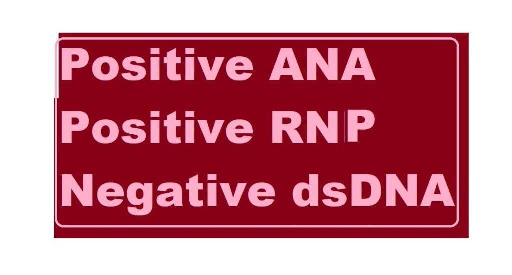 Positive ANA and Positive Anti-RNP Antibodies negative dsDNA
