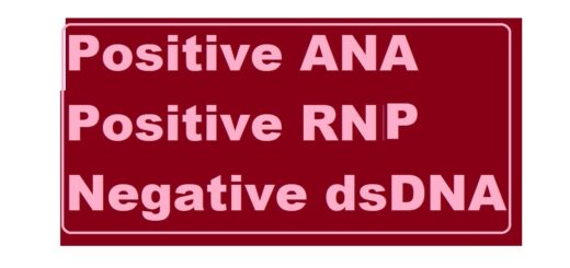 Positive ANA and Positive Anti-RNP Antibodies negative dsDNA