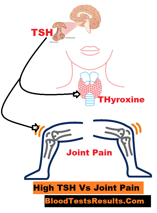 A simple diagram to illustrate how high TSH causes joint and knee pain