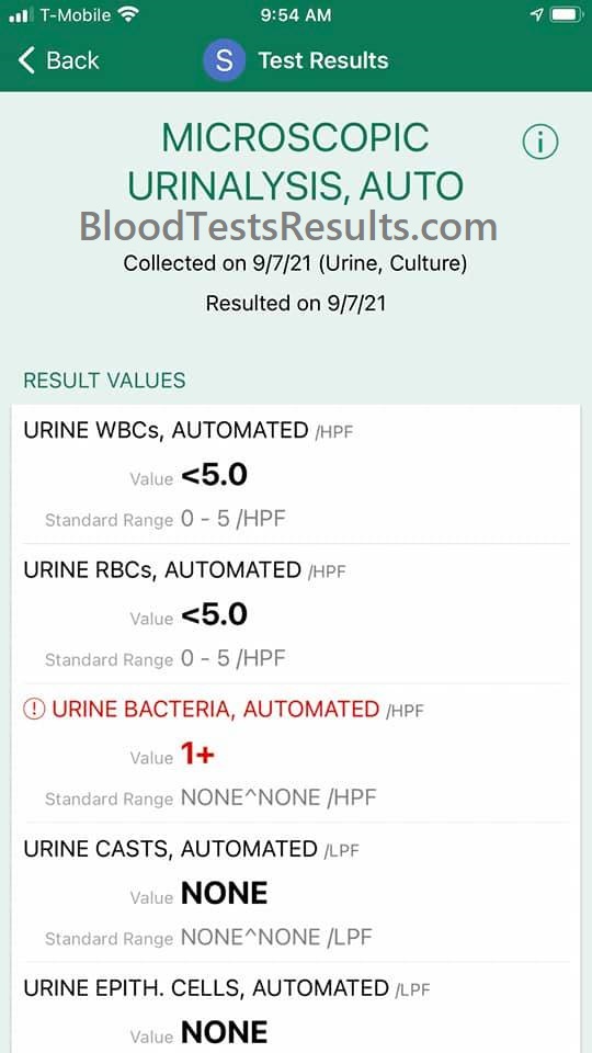 bacteria in urine testing report in absence of pus cells