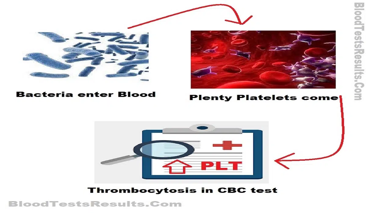 simple chart explain How can bacterial infection cause high platelets count
