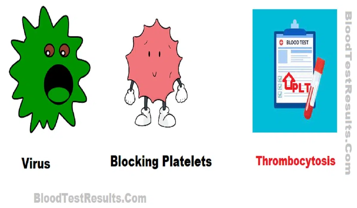 Simple chart explains the confusing in platelets count results in different viral infection